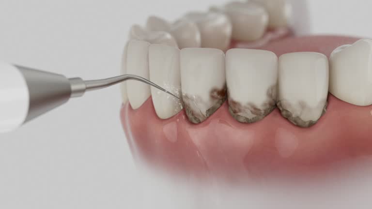 Trusted Root Canal Treatment service in Chevy Chase Village, MD - Dentist Open Now
